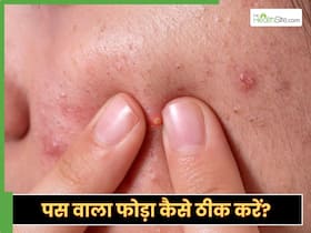 3 असरदार घरेलू नुस्खे जो दूर करेंगे पस वाले फोड़ों की समस्या, तीनों ही है कमाल