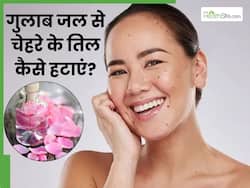 गुलाब जल से चेहरे के तिल कैसे हटाएं? इन 5 तरीकों से निकल जाएंगे सारे तिल और मस्से