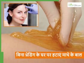 चीनी और नींबू से हटाएं माथे के अनचाहे बाल, अब बार-बार वैक्स और थ्रेडिंग करने की नहीं पड़ेगी जरूरत चीनी और नींबू से हटाएं माथे के अनचाहे बाल, अब बार-बार वैक्स और थ्रेडिंग करने की नहीं पड़ेगी जरूरत