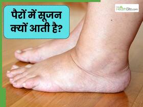 रात को पैरों में सूजन क्यों आ जाती है? ये 5 कारण हो सकते हैं जिम्मेदार
