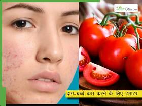 चेहरे के काले दाग हटाने के लिए टमाटर कैसे लगाएं? ये हैं टमाटर से ग्लोइंग स्किन पाने के 5 तरीके
