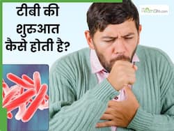 टीबी की शुरुआत कैसे होती है? जानें कब करना चाहिए डॉक्टर से संपर्क