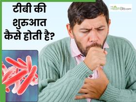 टीबी की शुरुआत कैसे होती है? जानें कब करना चाहिए डॉक्टर से संपर्क
