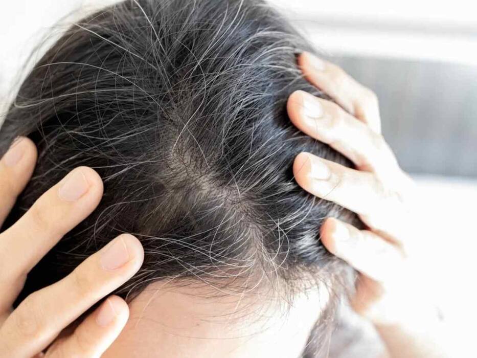 बालों में कैस्टर ऑयल लगाने से क्या होता है? ये हैं बालों में कैस्टर ऑयल लगाने के फायदे और सही  तरीका