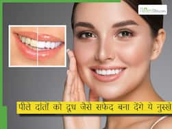 दांतों में बढ़ रही है कैविटी और पीलापन तो इन 4 चीजों से करें दांतों को साफ, मोती-से चमक उठेगे दांत