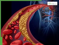 5 High Cholesterol Induced Heart Attack Symptoms