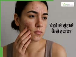 मुंहासों से हैं परेशान तो डाइट में शामिल करें ये 5 फूड्स, साफ दिखेगी स्किन