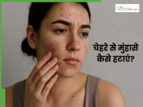 मुंहासों से हैं परेशान तो डाइट में शामिल करें ये 5 फूड्स, साफ दिखेगी स्किन