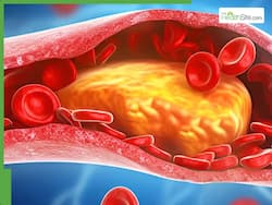 High Cholesterol Signs: 5 Morning Habits That Help Keep Your Bad Cholesterol in Check