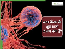 ब्लड कैंसर फर्स्ट स्टेज में दिखाई देते हैं ये 7 संकेत, डॉक्टर से जानिए शुरुआती लक्षण