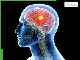 Brain Tumour Symptoms: 7 Early Warning Signs That You Should Never Ignore Brain Tumour Symptoms: 7 Early Warning Signs That You Should Never Ignore
