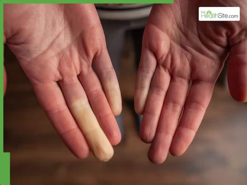 10 Unusual Heart Failure Signs That You Should Never Ignore