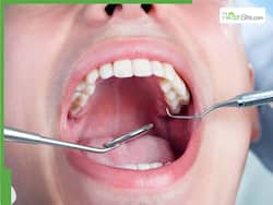 Oral Health: From Cavities To Gingivitis, 5 Dental Diseases And How To Prevent Them