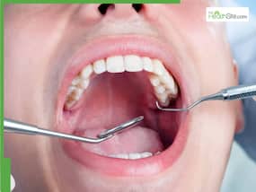 Oral Health: From Cavities To Gingivitis, 5 Dental Diseases And How To Prevent Them