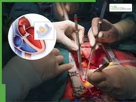 Heart Valve Replacement: How TAVR Is Replacing Open-Heart Surgery for Thousands of Patients Heart Valve Replacement: How TAVR Is Replacing Open-Heart Surgery for Thousands of Patients