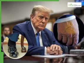 Trump Health News: What's Going On With The US President? A Complete Timeline of Donald Trump's Health Updates