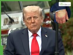 Donald Trump Health Update: Stroke Rumors Trend Online     Other Medical Conditions That Can Cause a Droopy Face