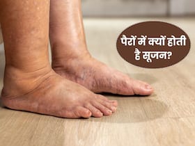 किन कारणों से होती है पैरों में सूजन? कहीं आप तो नहीं कर रहे नजरअंदाज