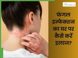 त्वचा पर फंगल संक्रमण का इलाज कैसे करें? जानें 5 देसी नुस्खे, जिनसे इन्फेक्शन का होगा इलाज