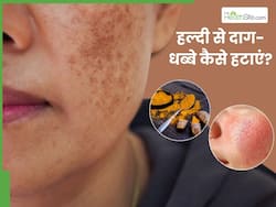 चेहरे के दाग-धब्बों को हटाए हल्दी कैसे लगाएं? जानें, लगाने का तरीका, जिससे स्किन पर आएगा निखार