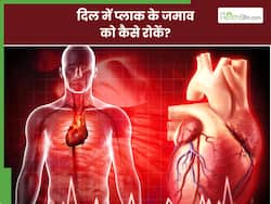 हार्ट में प्लाक को जमा होने से कैसे रोकें? एक्सपर्ट से जानिए किन तरीकों से दिल के ब्लॉकेज को करें कम