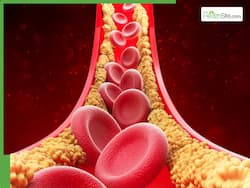 Lower High Cholesterol Naturally: 7 Simple Changes To Reduce Bad Cholesterol In 30 Days