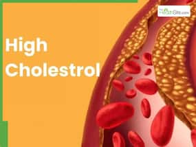 High Cholesterol: 5 Vegetables That Lower LDL Cholesterol And Keep Your Heart Healthy