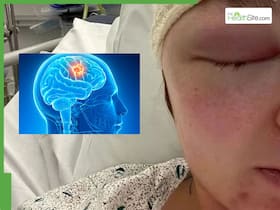 Teacher s Headaches Mistaken For Side Effect Of Contraceptive Pill Lead To Brain Tumor Diagnosis Teacher s Headaches Mistaken For Side Effect Of Contraceptive Pill Lead To Brain Tumor Diagnosis