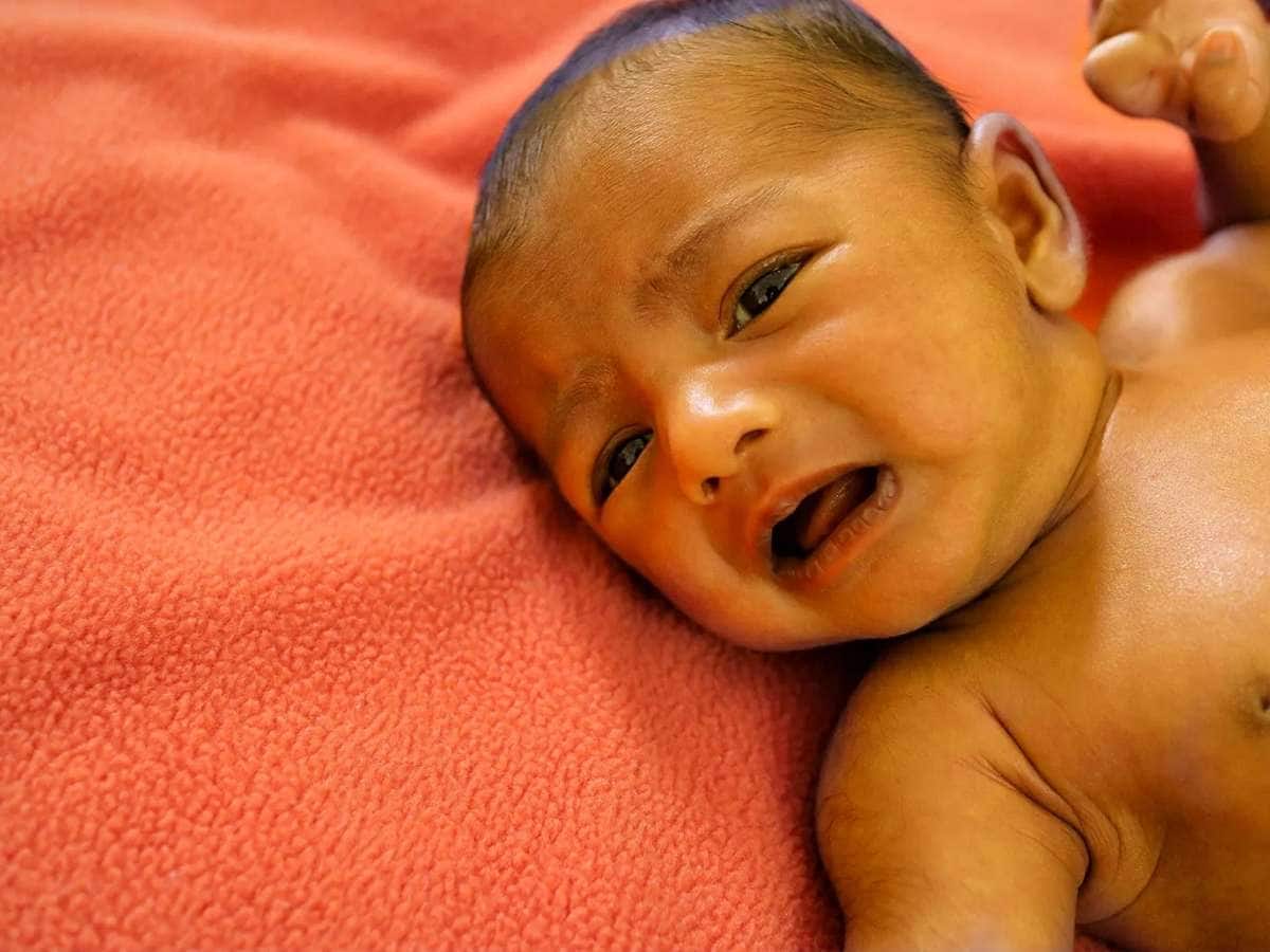 Jaundice In Kids (2)