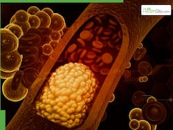 Cholesterol Lowering Ayurvedic Hacks: Life Saving Tips To Flush Out Bad LDL Naturally