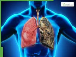World Lung Day 2025: 7 Lung Disease Symptoms You Shouldn   t Ignore