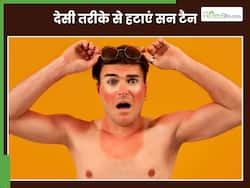 चेहरे की टैनिंग मिनटों में हटाए ये 5 देसी नुस्खे, हफ्तेभर में चांद सा खिल उठेगा चेहरा