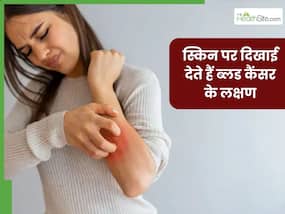 ब्लड कैंसर होने पर त्वचा पर दिखाई देते हैं ये 5 लक्षण, भूलकर भी न करें नजरअंदाज