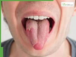 Is Your Tongue Warning You About Heart Disease? Signs You Shouldn   t Ignore