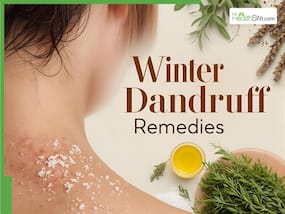 Dandruff In Winter Solutions: Best Ayurvedic Homemade Oils To Soothe Dry And Itchy Scalp Naturally