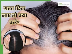 सफेद होते बाल होने लगेंगे काले, आजमाएं 5 आयुर्वेदिक उपाय, जो जड़ से खत्म करेंगे प्रीमेच्योर वाइट हेयर