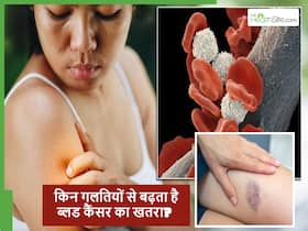 ये 5 गलतियां करते हैं तो ब्लड कैंसर से बचना मुश्किल, किसी भी उम्र में हो सकता है विकसित ये 5 गलतियां करते हैं तो ब्लड कैंसर से बचना मुश्किल, किसी भी उम्र में हो सकता है विकसित