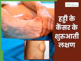 हड्डी में कैंसर के 5 संकेत जिन्हें शुरु में ज्यादातर लोग कर देते हैं इग्नोर, कहीं आप तो नहीं कर रहे ये गलती हड्डी में कैंसर के 5 संकेत जिन्हें शुरु में ज्यादातर लोग कर देते हैं इग्नोर, कहीं आप तो नहीं कर रहे ये गलती