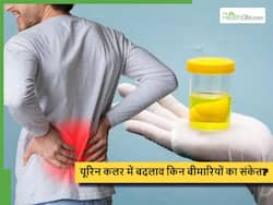यूरिन का कलर बताएगा किसी भी समय डैमेज हो सकती है आपका किडनी, ज्यादातर कर देते हैं इग्नोर