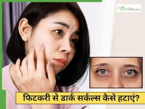 क्या आंखों के नीचे के डार्क सर्कल्स को हल्का करने में फिटकरी फायदेमंद है? जानें कैसे करें इस्तेमाल