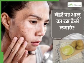 चेहरे पर आलू का रस कैसे लगाएं? जानें 5 तरीके जिनसे मिट जाएंगे दाग धब्बे चेहरे पर आलू का रस कैसे लगाएं? जानें 5 तरीके जिनसे मिट जाएंगे दाग धब्बे