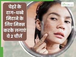 दाग-धब्बों से परेशान हैं तो इन 2 चीजों को मिक्स करके लगाना है फायदेमंद, जानें क्या लगाने से मिलेगा फायदा