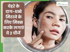 दाग-धब्बों से परेशान हैं तो इन 2 चीजों को मिक्स करके लगाना है फायदेमंद, जानें क्या लगाने से मिलेगा फायदा