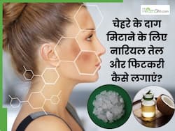 चेहरे के दाग मिटाने के लिए नारियल तेल और फिटकरी कैसे लगाएं? जानें 5 तरीके, जिनसे दूर होगी समस्या