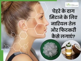 चेहरे के दाग मिटाने के लिए नारियल तेल और फिटकरी कैसे लगाएं? जानें 5 तरीके, जिनसे दूर होगी समस्या चेहरे के दाग मिटाने के लिए नारियल तेल और फिटकरी कैसे लगाएं? जानें 5 तरीके, जिनसे दूर होगी समस्या
