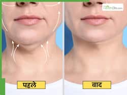 Double Chin को कैसे कम करें? 3 एक्सरसाइज से मिलेगी परफेक्ट फेस शेप
