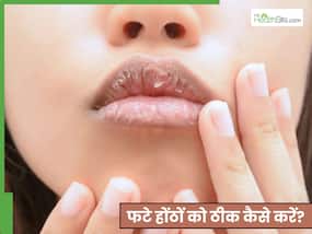 होंठों की पपड़ी कैसे साफ करें? जानें 3 नुस्खे, जिनसे नहीं फटेंगे लिप्स