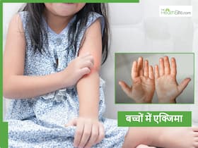 बच्चों में एक्जिमा के शुरुआती लक्षण और इलाज
