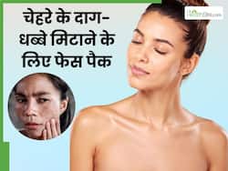 चेहरे के दाग धब्बे मिटाने के लिए कौन से फेस पैक लगाएं? ये 5 हैं बेहद असरदार