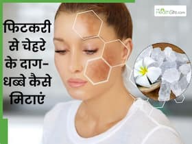चेहरे के दाग धब्बे मिटाने के लिए फिटकरी में मिलाकर लगाएं ये 5 चीजें, खिल जाएगी त्वचा